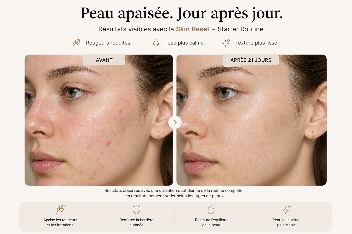 🌱 Skin Reset - Starter Routine