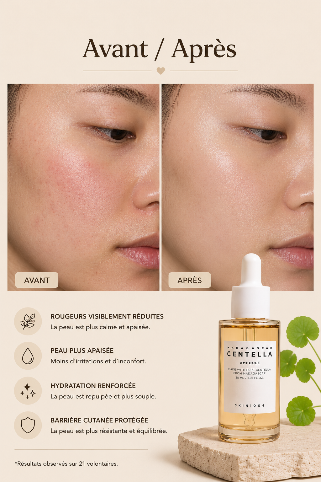 SKIN1004 - Madagascar Centella Ampoule