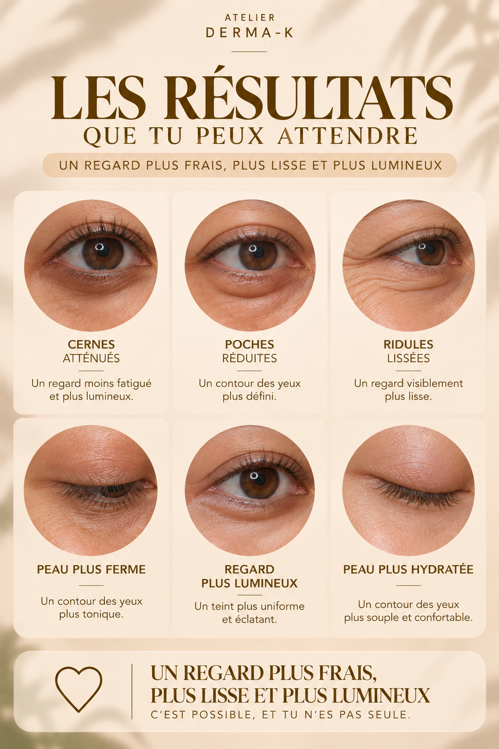 👀 Glow Eyes - Cernes & poches